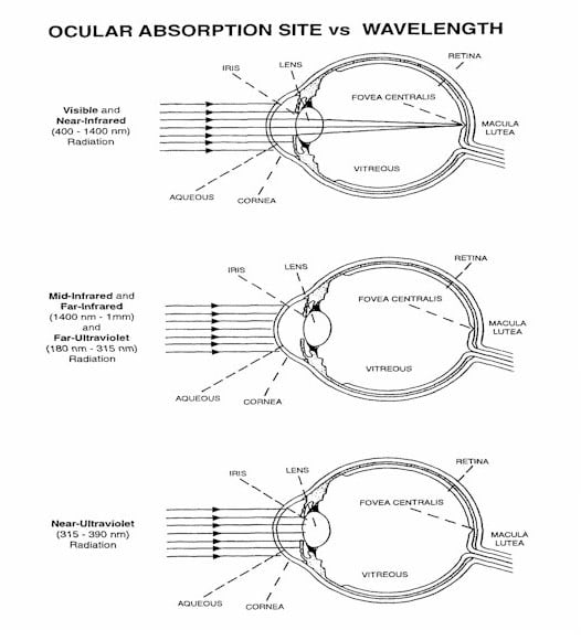 Laser light conditions & eye injury level SKAdvanced