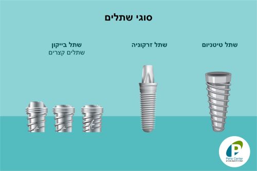 שתלים דנטליים - סוגי שתלים להשתלה דנטלית - פריוסנטר